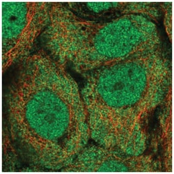 ALDH1A3 Antibody, Novus Biologicals 25 &mu;L, Unlabeled:Antibodies, Polyclonal