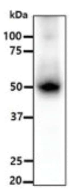 ALDH5A1 Mouse anti-Human, Clone: 17F5, Novus Biologicals:Antibodies:Primary