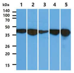 Aldolase C Mouse anti-Human, Mouse, Clone: 2.00E+11, Novus Biologicals
