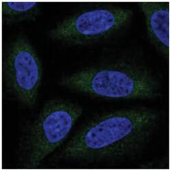 ALG6 Antibody, Novus Biologicals 100 &mu;L | Buy Online | Novus Biologicals | Fisher Scientific