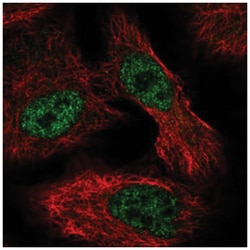 ALKBH6 Antibody, Novus Biologicals 25 &mu;L, Unlabeled:Antibodies, Polyclonal