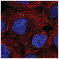 alpha 1-Acid Glycoprotein Antibody, Novus Biologicals 100&mu;L; Unlabeled:Antibodies,