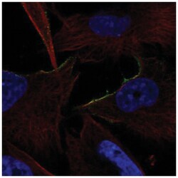 alpha-1B Adrenergic R/ADRA1B Antibody, Novus Biologicals 25 &mu;L, Unlabeled:Antibodies,