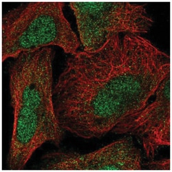 alpha-N-terminal Methyltransferase 1A/METTL11A Antibody, Novus Biologicals
