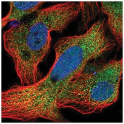 AlphaA Crystallin/CRYAA Antibody, Novus Biologicals:Antibodies:Primary