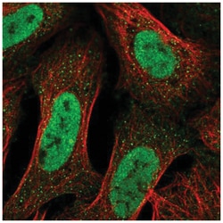 ALS2CR3 Antibody, Novus Biologicals 100&mu;L; Unlabeled:Antibodies, Polyclonal