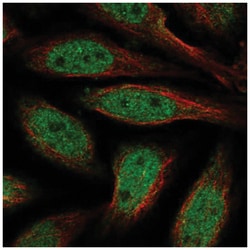 ALX4 Antibody, Novus Biologicals 25 &mu;L:Antibodies, Polyclonal