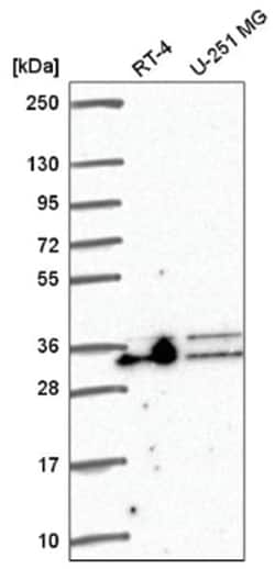 Aly Antibody, Novus Biologicals 100&mu;L; Unlabeled:Antibodies, Polyclonal