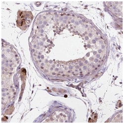 AMMECR1 Antibody, Novus Biologicals 25 &mu;L:Antibodies, Polyclonal