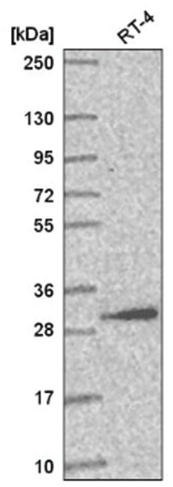 AMMECR1L Antibody, Novus Biologicals 100&mu;L; Unlabeled:Antibodies, Polyclonal