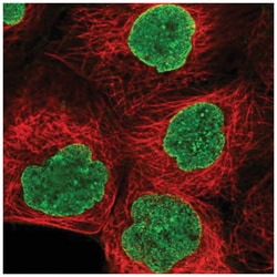 AMPD3 Antibody, Novus Biologicals:Antibodies:Primary Antibodies