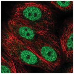 ANAPC2 Antibody, Novus Biologicals 100&mu;L; Unlabeled:Antibodies, Polyclonal