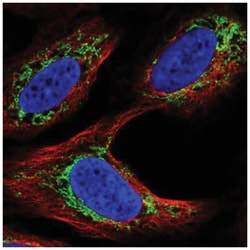 Androgen R/NR3C4 Antibody, Novus Biologicals 25 &mu;L:Antibodies, Polyclonal