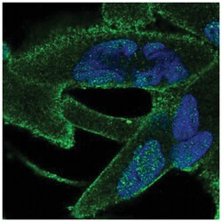 ANKRA2 Antibody, Novus Biologicals:Antibodies:Primary Antibodies