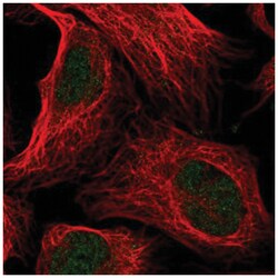 ANKRD11 Antibody, Novus Biologicals 100&mu;L; Unlabeled:Antibodies, Polyclonal