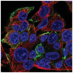 ANKRD15 Antibody, Novus Biologicals:Antibodies:Primary Antibodies
