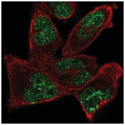 ANKRD17 Antibody, Novus Biologicals:Antibodies:Primary Antibodies