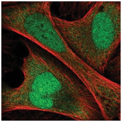 ANKRD36C Antibody, Novus Biologicals:Antibodies:Primary Antibodies