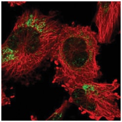 ANKRD44 Antibody, Novus Biologicals 100&mu;L; Unlabeled:Antibodies, Polyclonal
