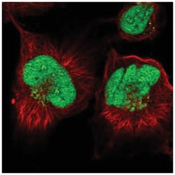 ANKRD49 Antibody, Novus Biologicals:Antibodies:Primary Antibodies