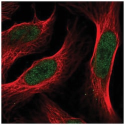 Annexin A8/ANXA8 Antibody, Novus Biologicals 25 &mu;L | Buy Online | Novus Biologicals | Fisher Scientific