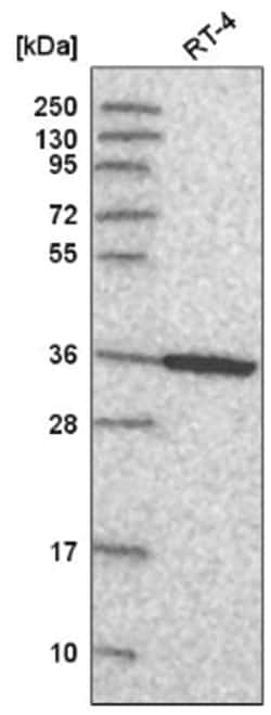 Annexin A8/ANXA8 Antibody, Novus Biologicals 100&mu;L; Unlabeled:Antibodies,