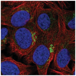 ANUBL1 Antibody, Novus Biologicals 100&mu;L; Unlabeled:Antibodies, Polyclonal