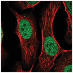 AP-2 gamma Antibody, Novus Biologicals 25 &mu;L:Antibodies, Polyclonal