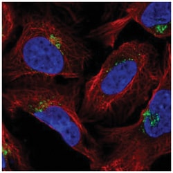 AP1AR Antibody, Novus Biologicals 25 &mu;L, Unlabeled:Antibodies, Polyclonal