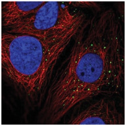 AP1M2 Antibody, Novus Biologicals 25 &mu;L:Antibodies, Polyclonal
