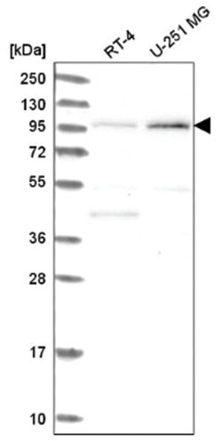 AP2A2 Rabbit anti-Human, Polyclonal, Novus Biologicals 100&mu;L; Unlabeled:Antibodies,