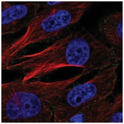 AP2M1 Antibody, Novus Biologicals 25 &mu;L:Antibodies, Polyclonal