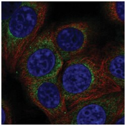 AP3D1 Antibody, Novus Biologicals 25 &mu;L, Unlabeled:Antibodies, Polyclonal