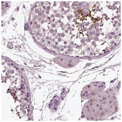 AP4M1 Antibody, Novus Biologicals:Antibodies:Primary Antibodies