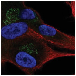 APBA1 Antibody, Novus Biologicals 100&mu;L; Unlabeled:Antibodies, Polyclonal