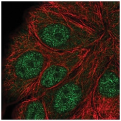 Apc5 Antibody, Novus Biologicals 25 &mu;L, Unlabeled:Antibodies, Polyclonal