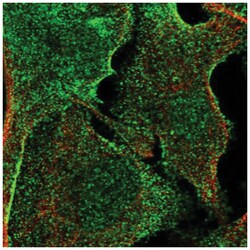 APMAP Antibody, Novus Biologicals 100&mu;L; Unlabeled:Antibodies, Polyclonal