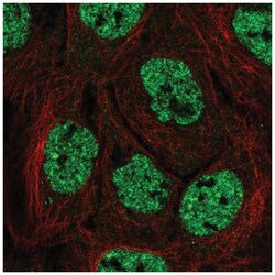 APOBEC3B Antibody, Novus Biologicals 100&mu;L; Unlabeled:Antibodies, Polyclonal