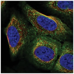 ARC/ARG3.1 Antibody, Novus Biologicals 100&mu;L; Unlabeled:Antibodies,