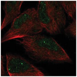 Archaemetzincin 2 Antibody, Novus Biologicals:Antibodies:Primary Antibodies