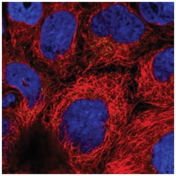 ARFRP1 Antibody, Novus Biologicals 100&mu;L; Unlabeled:Antibodies, Polyclonal
