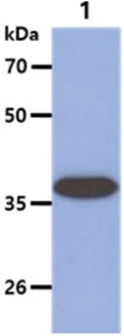 ARG2 Mouse anti-Human, Clone: 7F8, Novus Biologicals:Antibodies:Primary