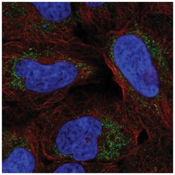 ARHGAP20 Antibody, Novus Biologicals:Antibodies:Primary Antibodies