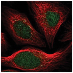 ARHGAP23 Antibody, Novus Biologicals 25 &mu;L:Antibodies, Polyclonal