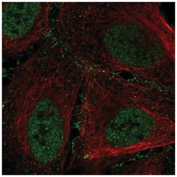 ARID1B Antibody, Novus Biologicals 25 &mu;L, Unlabeled:Antibodies, Polyclonal