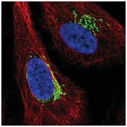 ARIH1 Antibody, Novus Biologicals 100&mu;L; Unlabeled:Antibodies, Polyclonal