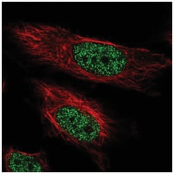 ARIH2 Antibody, Novus Biologicals 25 &mu;L, Unlabeled:Antibodies, Polyclonal