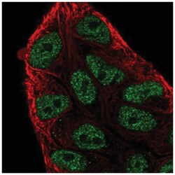 ARIH2 Antibody, Novus Biologicals 100&mu;L; Unlabeled:Antibodies, Polyclonal