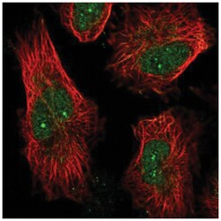 ARK5/NUAK1 Antibody, Novus Biologicals 100&mu;L; Unlabeled:Antibodies,