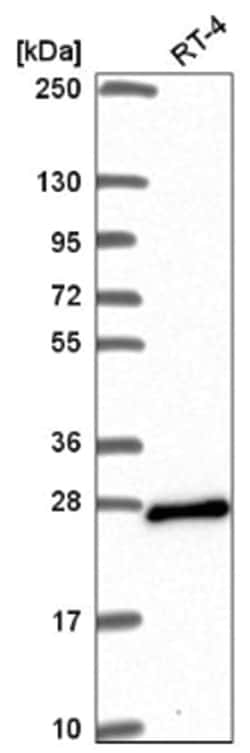 ARL15 Antibody, Novus Biologicals 100&mu;L; Unlabeled:Antibodies, Polyclonal